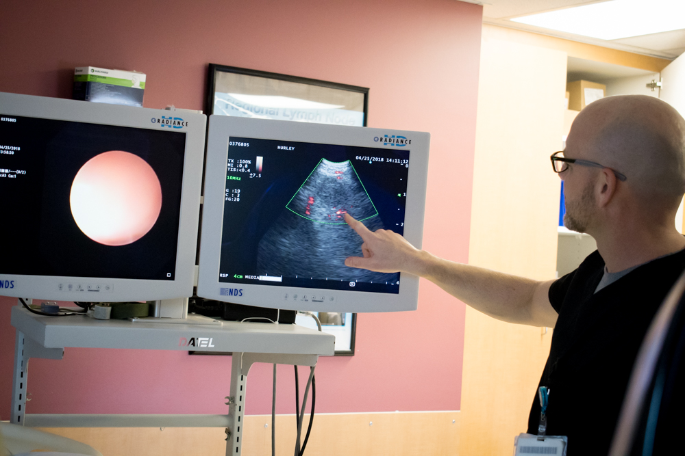 BRONCHOSCOPY-3951