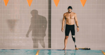 Advancements in Prosthetics LIGHTFIELD STUDIOS / stock.adobe.com